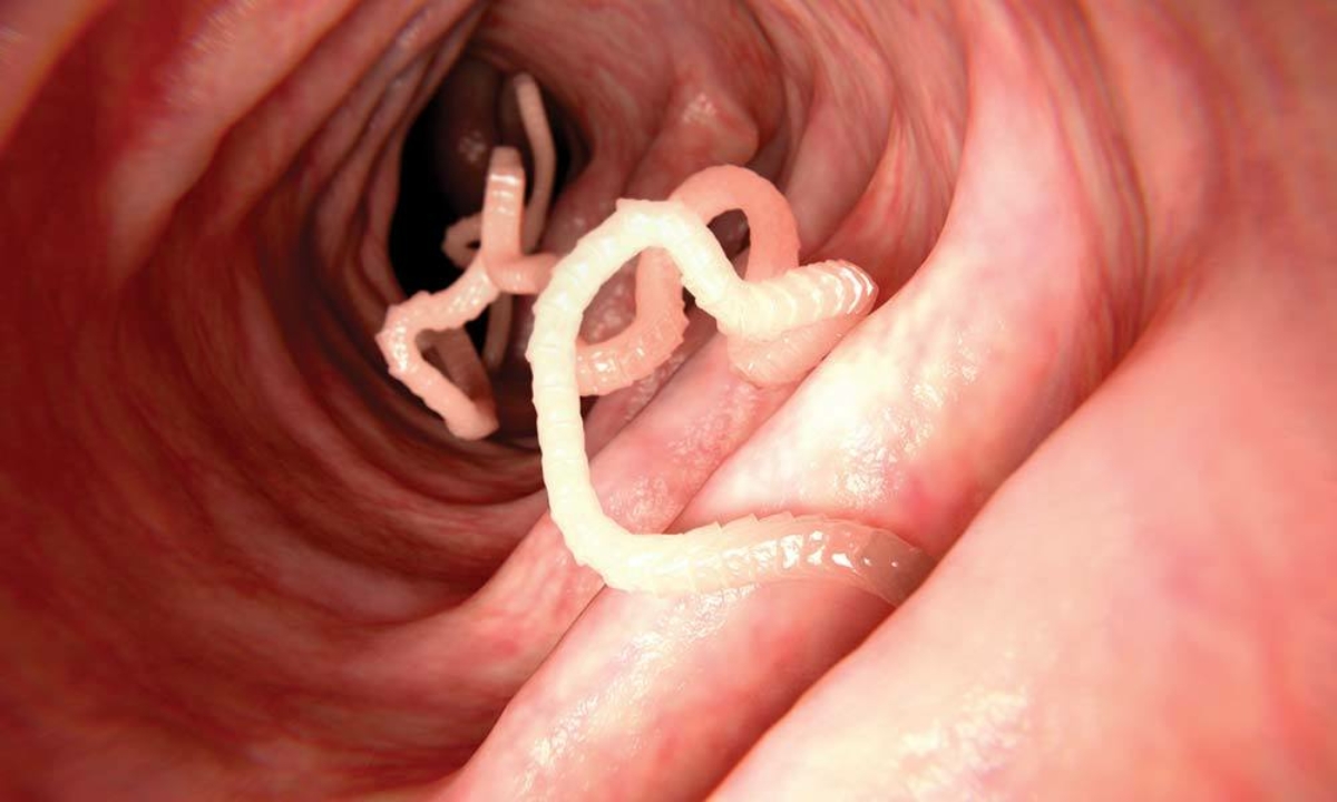 image of tapeworms in digestive tract