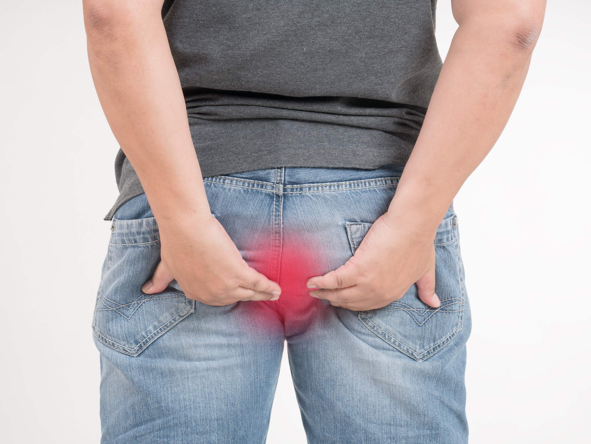 How Long Do Hemorrhoids Last Cary Gastroenterology Associates