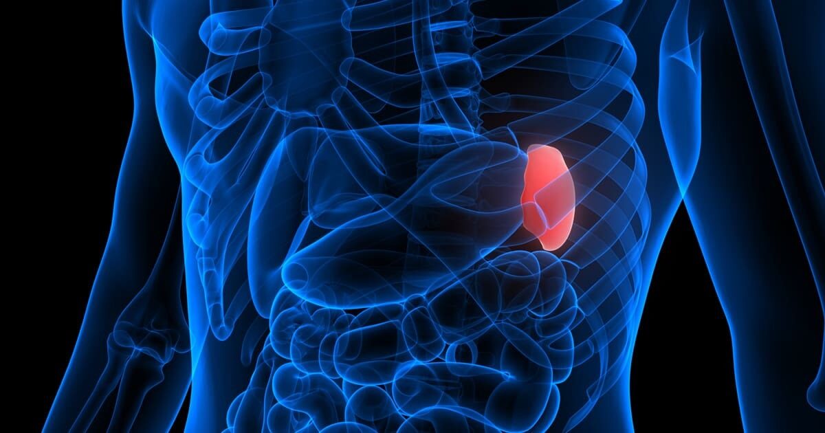 Cary Gastroenterology Associates | What Happens if a Spleen Ruptures?