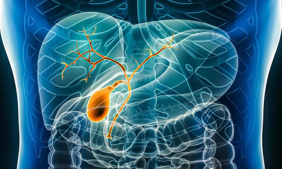 Cary Gastroenterology Associates | How Serious is Bile Duct Cancer?