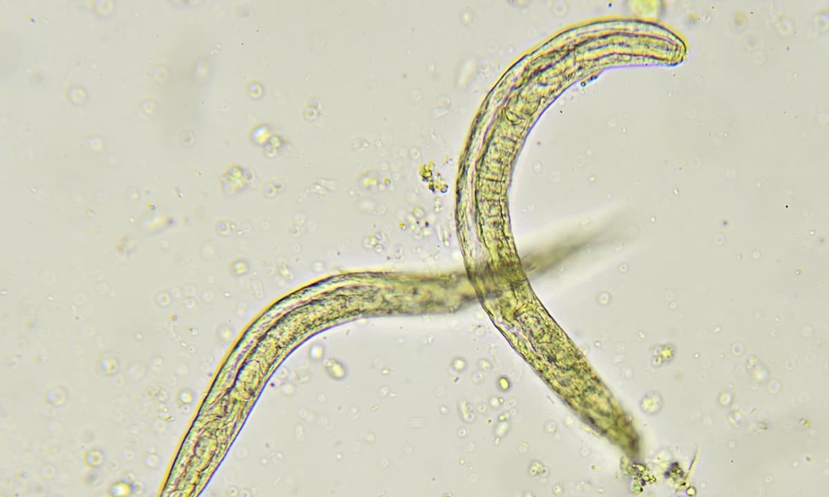tapeworm in human feces